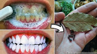 Secret that Dentists dont want you to know Remove Tartar and Teeth Whitening in just 2 minutes [upl. by Elly150]