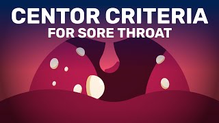 Is Your Sore Throat Caused by Bacterial Infection or Viral [upl. by Maudie]