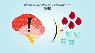 HypoxicIschemic Encephalopathy About Treatments amp Causes [upl. by Varney]