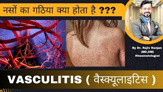 नसों का गठिया । Vasculitis Diseases  वैस्क्यूलाइटिस के बारे में जाने [upl. by Ocirred]