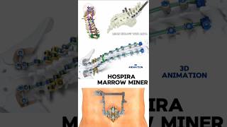 Hospira Marrow Miner 3d animation short  BiologywithAliya [upl. by Dave]