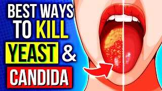 Effective Ways To Eradicate CANDIDA amp YEAST From Your Body 🦠 [upl. by Aimee89]