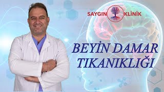 Beyin Damar Tıkanıklığı Tedavileri [upl. by Felten]