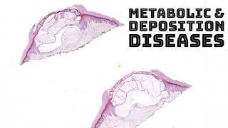 Metabolism amp Deposition Diseases in Skin dermatology dermpath pathology board review [upl. by Feucht789]