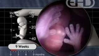 Fetal Development  The Eyelids Close [upl. by Deck]