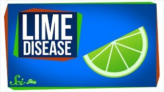 Lime Disease How a Fruity Drink Can Give You a Rash [upl. by Karna]