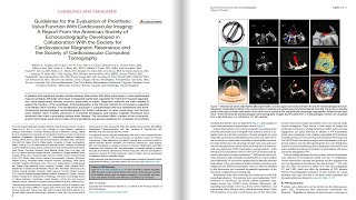 2024 ASE guidelines on Prosthetic Valve Assessment [upl. by Notlrak]