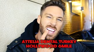 HOLLYWOOD SMILE  ATTELIA DENTAL TURKEY [upl. by Mokas]