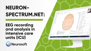 EEG Recording and Analysis in Intensive Care Units ICU using NeuronSpecrtrumNET [upl. by Zamora]