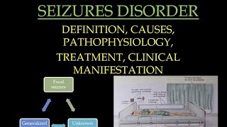 Seizures in hindiDEFINITION causes PATHOPHYSIOLOGY management MEDICALwithNO [upl. by Enyala]