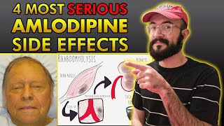 4 Most SERIOUS Amlodipine Side Effects [upl. by Sidoma312]