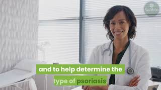 Guttate Psoriasis Causes Diagnosis and Treatments [upl. by Valery]