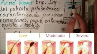 Erysipelothrix RhusiopathiaeListeria MonocytogenesCutibacterium Acnes Corynebacterium Diphtheriae [upl. by Ruprecht]