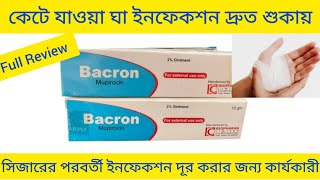 Bacron Ointment Bangla কেটে যাওয়া ঘা এবং ইনফেকশন ভালো করার ঔষধ Bacron Ointment এর কাজ কি Bacron [upl. by Duthie]