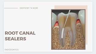 ROOT CANAL SEALERS [upl. by Leontina953]