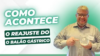 BALÃO GÁSTRICO COMO ACONTECE O REAJUSTE [upl. by Mercado]