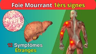 12 Symptômes Étranges Indiquant un Problème de Foie et Solutions Naturelles [upl. by Eelah]