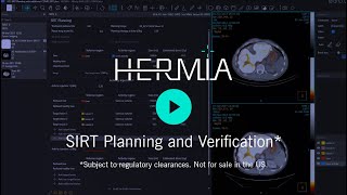 Hermia SIRT For Selective Internal Radiation Therapy [upl. by Salisbarry]