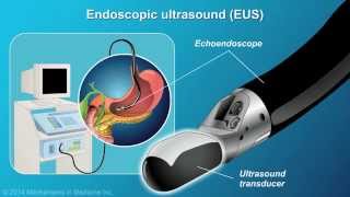 Understanding EUSFNA [upl. by Pallua337]