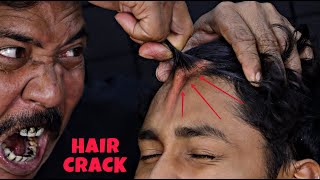 Unlimited Hair Cracking by Asim Barber  Head massage amp Neck Cracking  Loud Spine Cracking  ASMR [upl. by Mikal453]