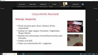 TEORIA 6 NEONATOLOGIA [upl. by Allevon]