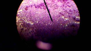 STAPHYLOCOCCUS EPIDERMIDISGRAM STAINED [upl. by Avirt]