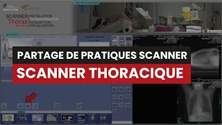 CT Scanner THORACIQUE Sans Injection  Partage de Pratiques [upl. by Tobin]