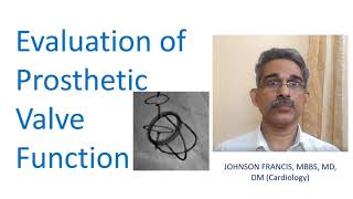 Evaluation of Prosthetic Valve Function [upl. by Jenny]