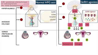 Gonadotropinreleasing hormone GnRH agonists [upl. by Alisha]