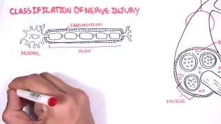 Neurology  Nerve Damage and Regeneration [upl. by Nodlew]