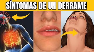 7 SÍNTOMAS de un ACV Derrame Cerebral antes de que OCURRA [upl. by Ennazus]