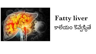 All about Fatty Liver in TeluguNAFLDliver fibrosis cirrhosis fattyliver [upl. by Willtrude577]