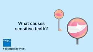 What causes sensitive teeth  Dental Hygiene  Bupa Health [upl. by Nnarefinnej]