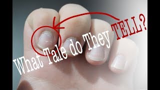 A Study in Fingernails Day to Day Deductions Docuvlog 1 [upl. by Nessie]