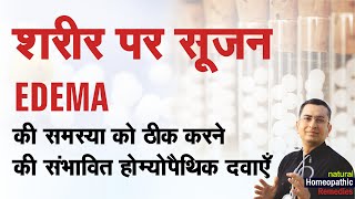 शरीर पर सूजन  Edema  Oedema  Natural homeopathic remedies with symptoms [upl. by Coates]