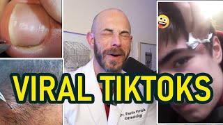 Dermatologists JawDropping Reaction to Amazing Pimple Pops [upl. by Anilac]