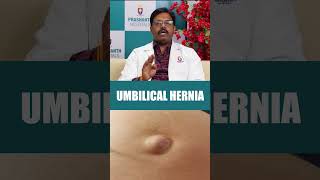 How to check yourself for an Umbilical Hernia prashanthhospitals UmbilicalHerniaCheck healthcare [upl. by Shererd14]