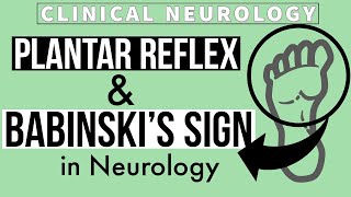 PLANTAR REFLEX  BABINSKIs SIGN  Equivocal Plantar  Other methods  Clinical Neurology [upl. by Yelhsa]