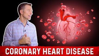 Two Causes of Coronary Heart Disease Its Not Saturated Fat – Dr Berg [upl. by Staffan]