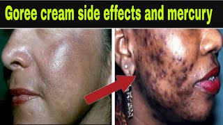 Goree cream side effects and Mercury  for Benefits [upl. by Alegnasor]