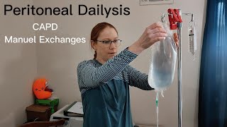 Peritoneal Dialysis Catheter Transfer Set Change [upl. by Peria]