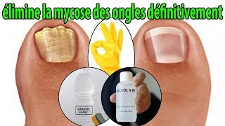 élimine la mycose des ongles définitivement  conseils [upl. by Eutnoj]