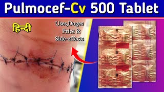 Pulmocef Cv 500 Tablet  Cefuroxime axetil Tablets Review in Hindi  by Mt discuss [upl. by Ennahs275]