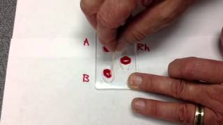 Synthetic Blood Typing B [upl. by Eelidnarb107]