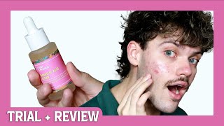 good molecules mandelic acid serum  trial  review [upl. by Bocaj]