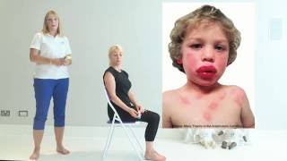 Top Tips for Anaphylaxis  First Aid [upl. by Nilson]