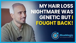 My HAIR LOSS Nightmare Was Genetic But I Fought Back [upl. by Kalle]