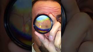 How to Do Your Own Fundus Exam [upl. by Uela]