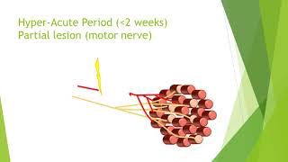 Nerve damage and repair [upl. by Granville365]