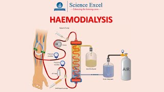 Haemodialysis  Science Excel [upl. by Leahcimrej390]